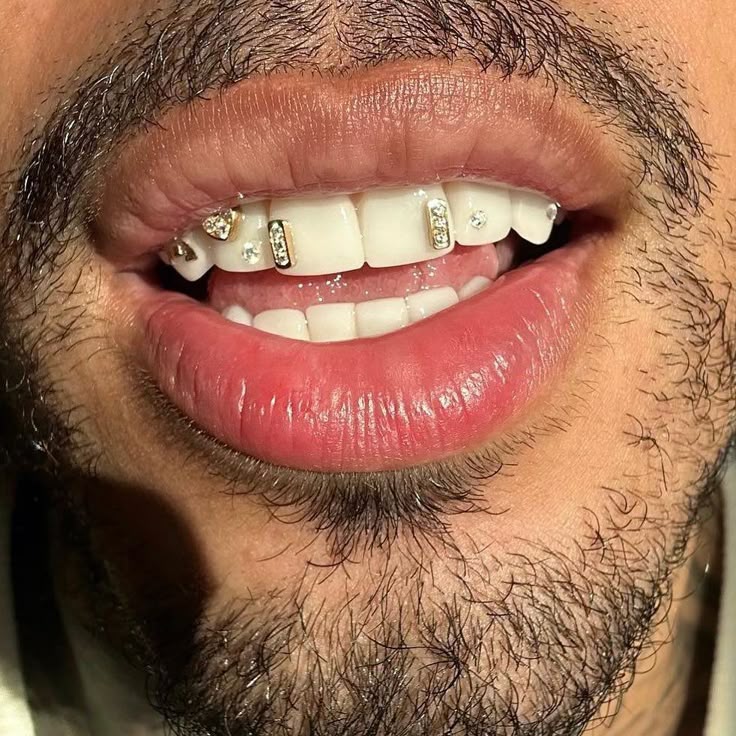 Tooth Jewellery Treatment