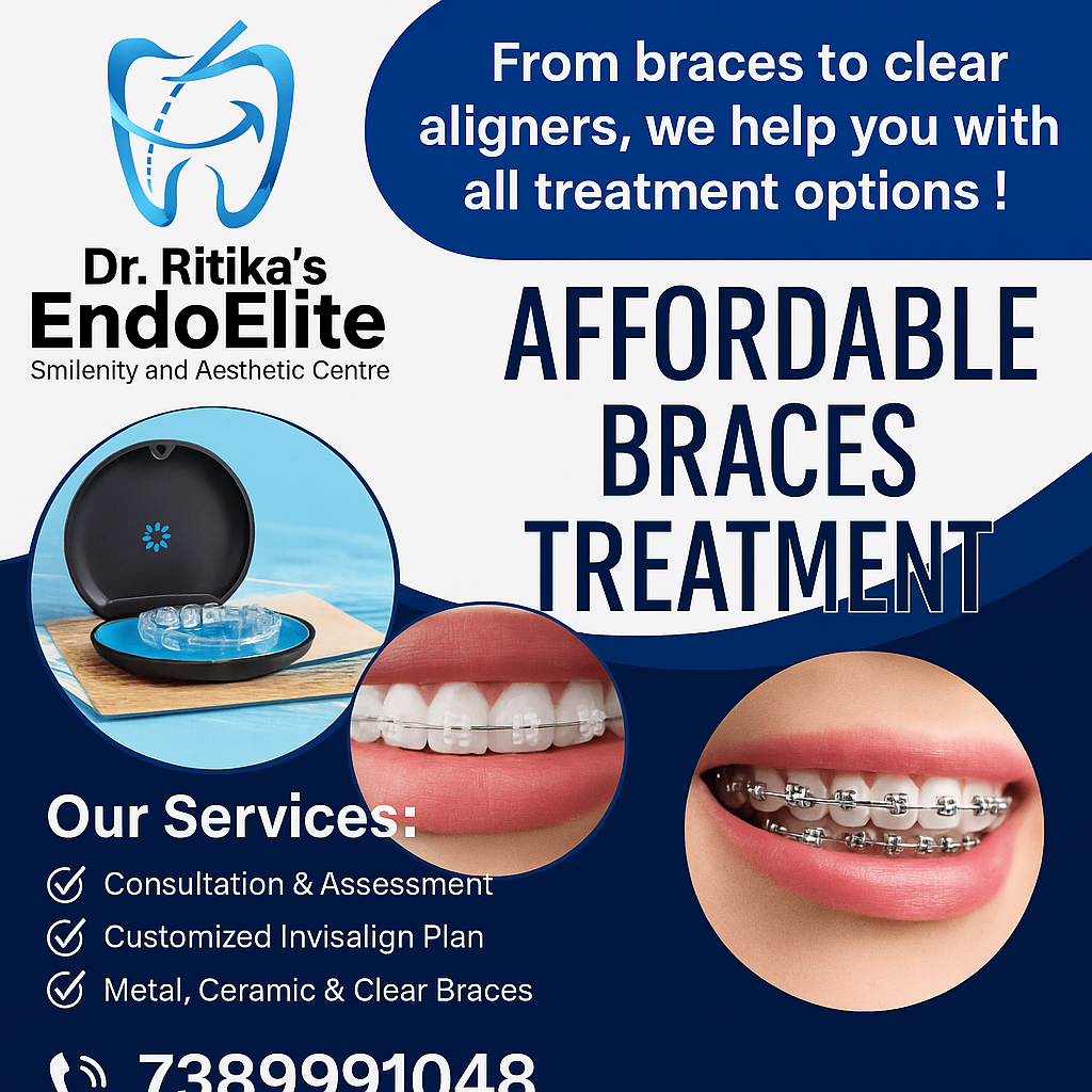 Braces Treatment Procedure