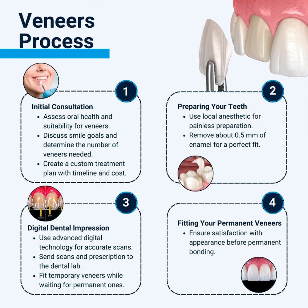 Laminates & Veneers Procedure